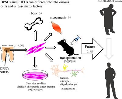 Characteristics and Therapeutic Potential of Dental Pulp Stem Cells on Neurodegenerative Diseases